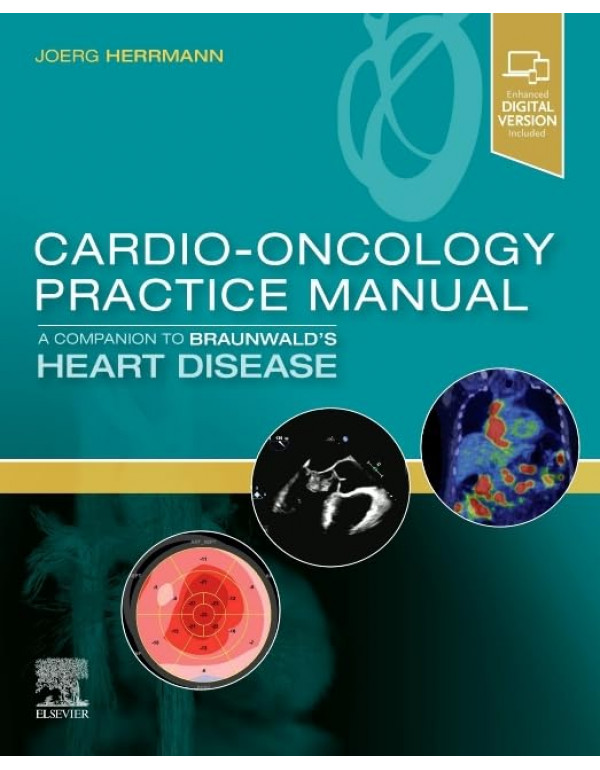 Cardio-Oncology Practice Manual: A Companion to Braunwald’s Heart Disease by Joerg Herrmann