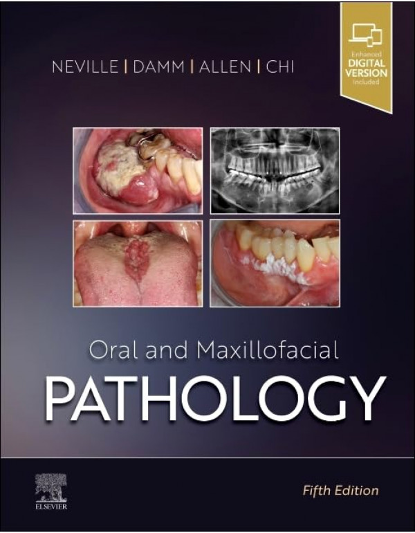 Oral and Maxillofacial Pathology, 5th edition by Brad W. Neville, Douglas D. Damm, Carl M. Allen