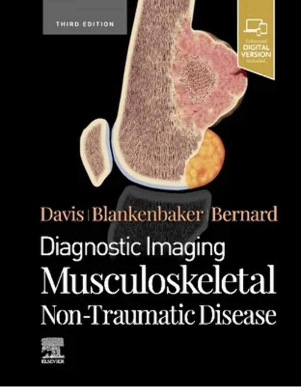 Diagnostic Imaging: Musculoskeletal Non-Traumatic Disease, 3rd edition by Kirkland W. Davis, Donna G Blankenbaker, Stephanie Bernard