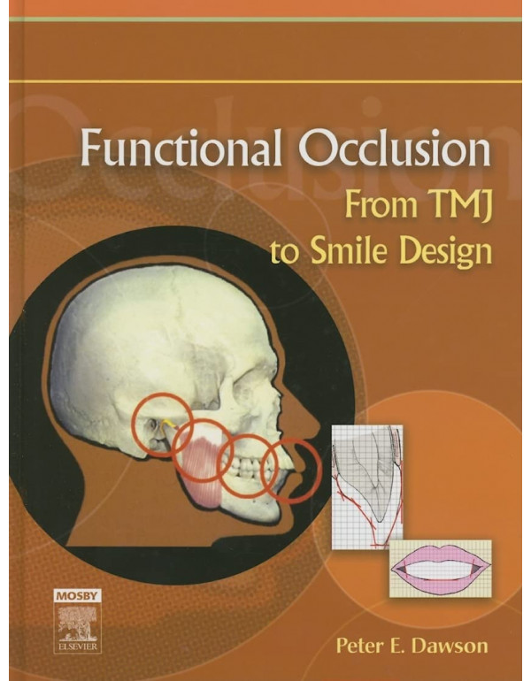 Functional Occlusion: From TMJ to Smile Design Boo...