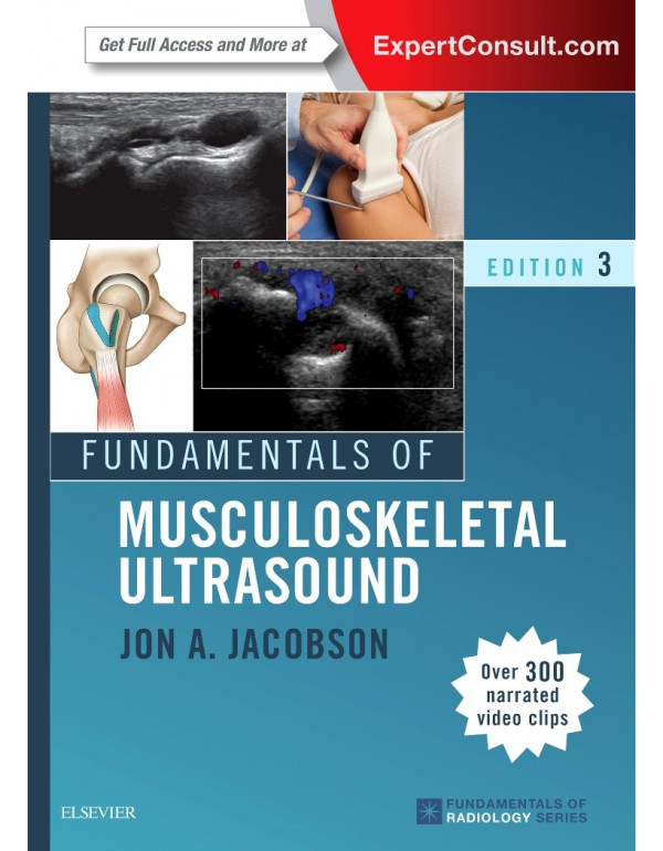 Fundamentals of Musculoskeletal Ultrasound (Fundamentals of Radiology) by Jon A. Jacobson MD