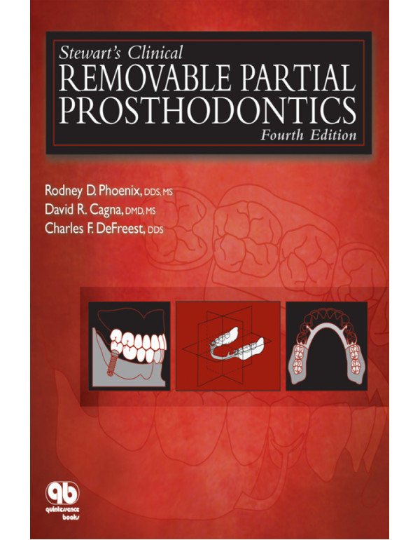 Stewart's Clinical Removable Partial Prosthodontics 4th Ed. by Rodney D. Phoenix, David R. Cagna *DOWNLOAD VERSION*
