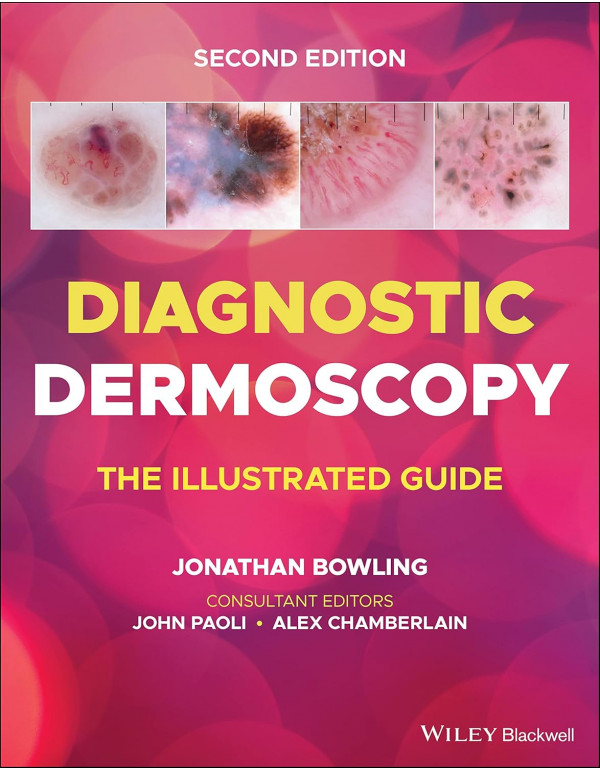 Diagnostic Dermoscopy: The Illustrated Guide (2nd Edition) by Jonathan Bowling – 9781118930489 - Paperback