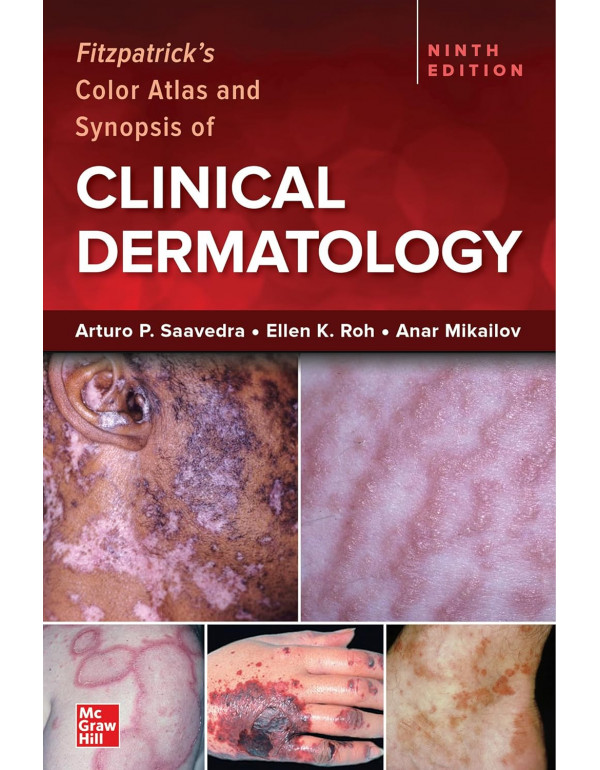Fitzpatrick's Color Atlas and Synopsis of Clinical Dermatology by Arturo P. Saavedra, Ellen K. Roh, Anar Mikailov, 9th edition *DOWNLOAD VERSION*