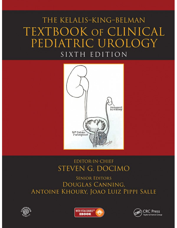 The Kelalis--King--Belman Textbook of Clinical Ped...