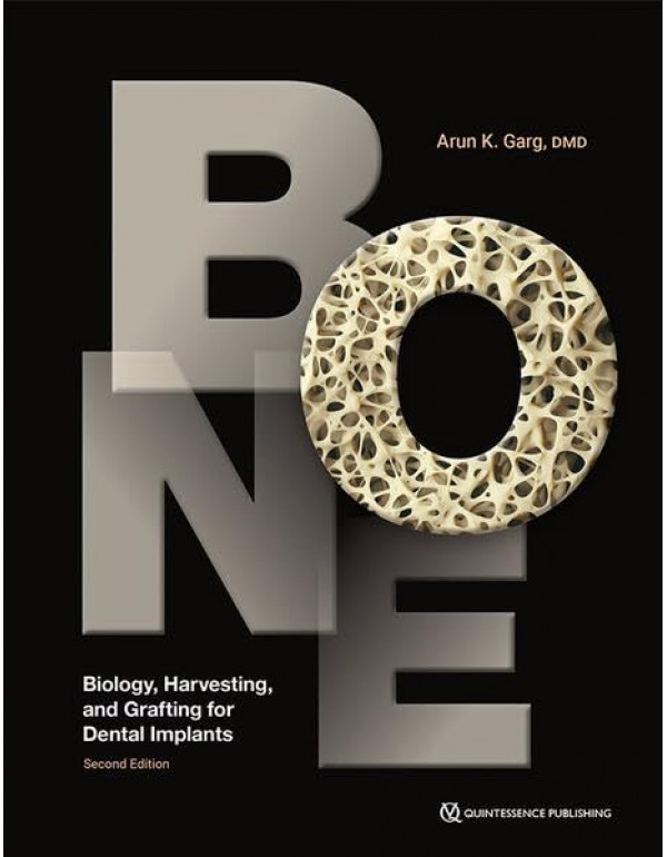 Bone: Biology, Harvesting, and Grafting for Dental Implants, 2nd Edition by Arun K. Garg – Hardcover (ISBN: 9781647241704)