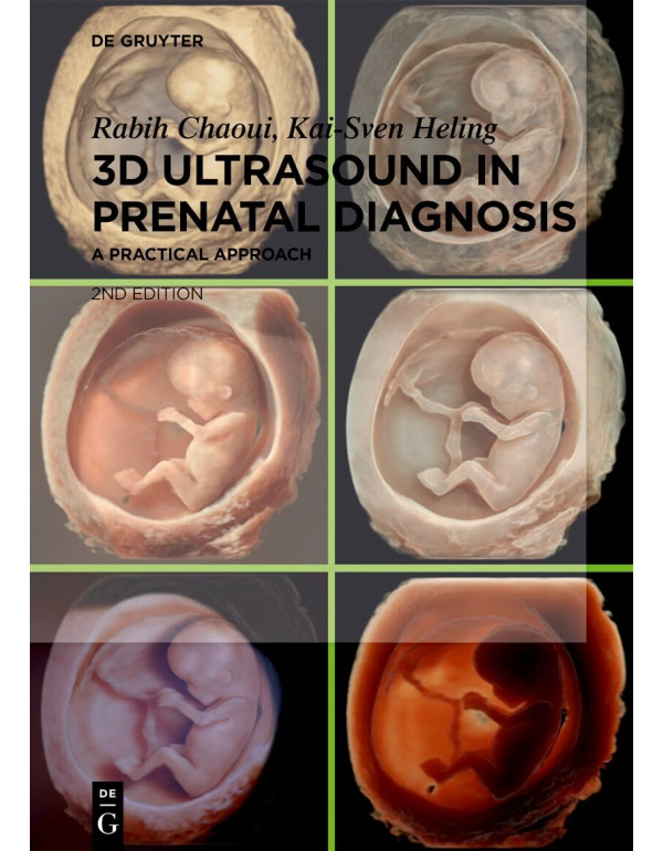 3D Ultrasound in Prenatal Diagnosis: A Practical Approach, 2nd Edition by Rabih Chaoui and Kai-Sven Heling – Hardcover (ISBN: 9783111249094)