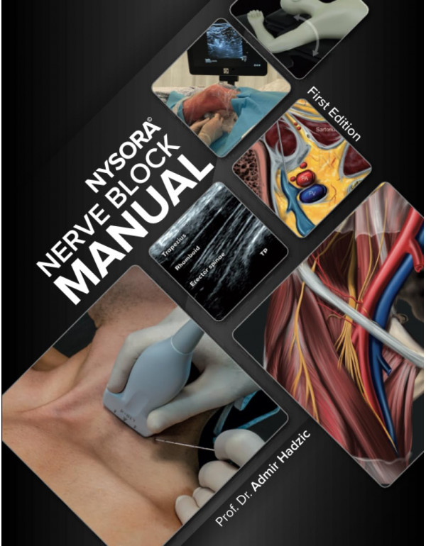 NYSORA Nerve Block Manual: First Edition by Admir Hadzic - {9798987050507}