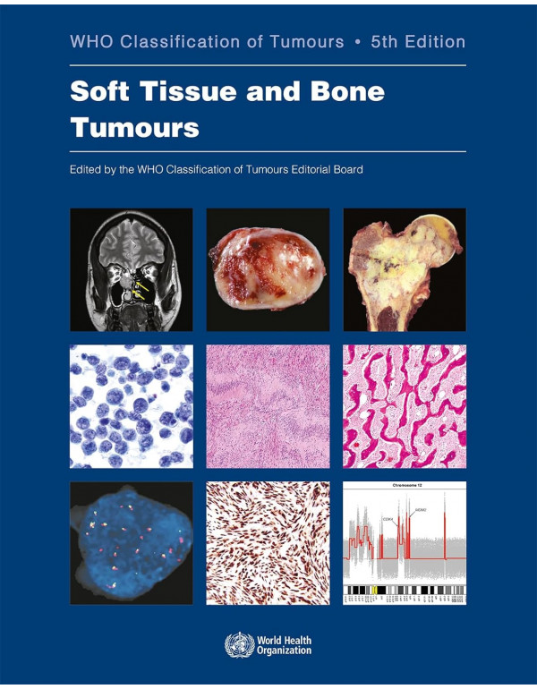 Soft Tissue And Bone Tumours: WHO Classification O...