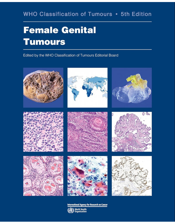 Female Genital Tumours: WHO Classification of Tumours (Medicine) by WHO Classification of Tumours Editorial Board, 5th edition *DOWNLOAD VERSION*