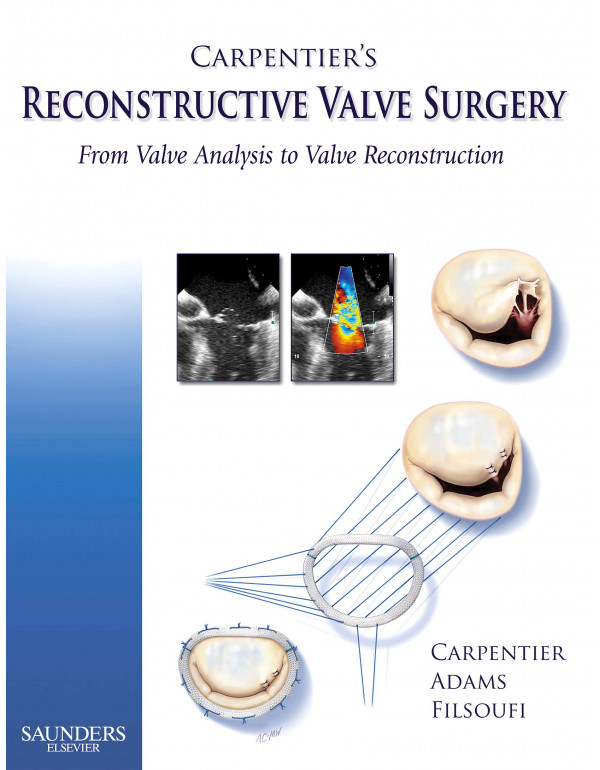 Carpentier's Reconstructive Valve Surgery *US HARD...