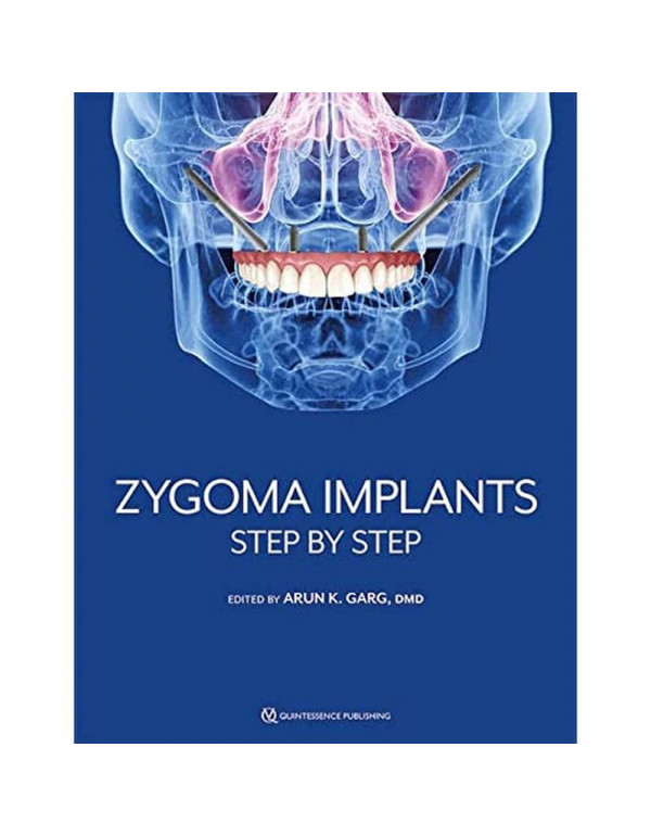 Zygoma Implants: Step by Step by Arun K. Garg *US HARDCOVER*