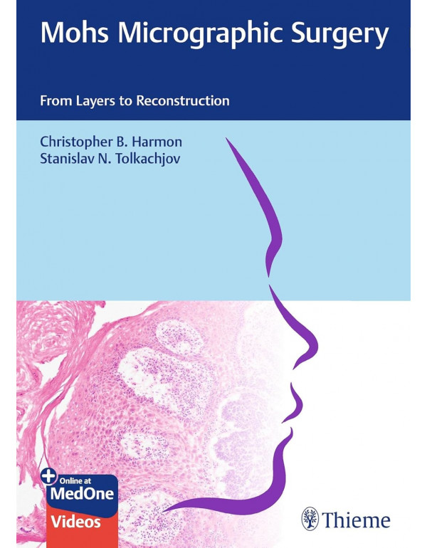 Mohs Micrographic Surgery: From Layers to Reconstruction by Christopher B. Harmon, Stanislav N. Tolkachjov *US HARDCOVER*