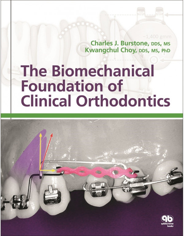 The Biomechanical Foundation of Clinical Orthodontics *US HARDCOVER* by Charles Burstone, Kwangchul Choy - {9780867156515}