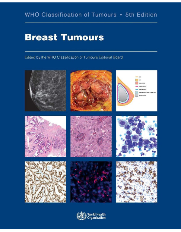 Breast Tumours: WHO Classification of Tumours, 5th Edition (ISBN 9789283245001) - Paperback