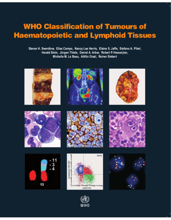 WHO classification of tumours of haematopoietic and lymphoid tissues: Vol. 2 by WHO Classification of Tumours Editorial Board {9789283244943} {928324494X}