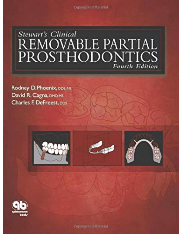 Stewart's Clinical Removable Partial Prosthodontics (Phoenix, Stewart's Clinical Removable Partial Prosthodontics) 4th Edition