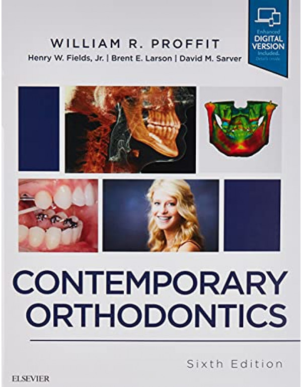 Contemporary Orthodontics by William R. Proffit DD...