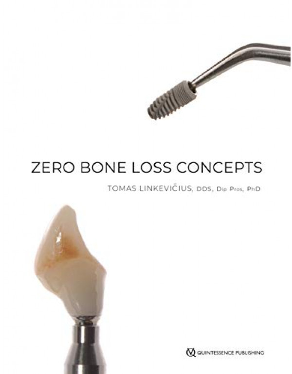 Zero Bone Loss Concepts *US HARDCOVER* by Tomas Linkevicius - {9780867157994} {0867157992}