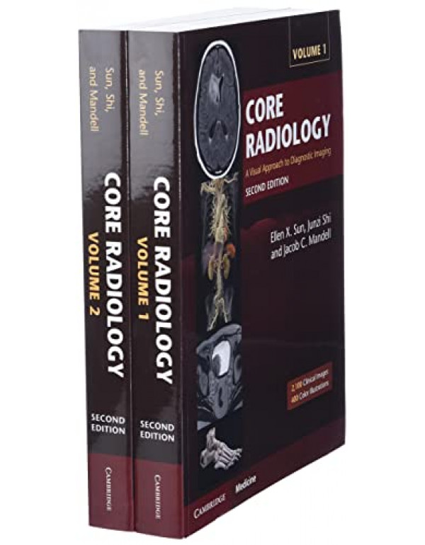 Core Radiology 2 Vol. Set *US PAPERBACK* 2nd Ed. A Visual Approach to Diagnostic Imaging by Ellen X. Sun, Junzi Shi