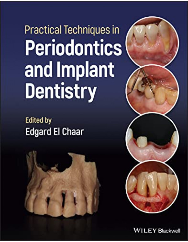 Practical Techniques in Periodontics and Implant Dentistry *US HARDCOVER* by Edgard El Chaar - {9781119793557}