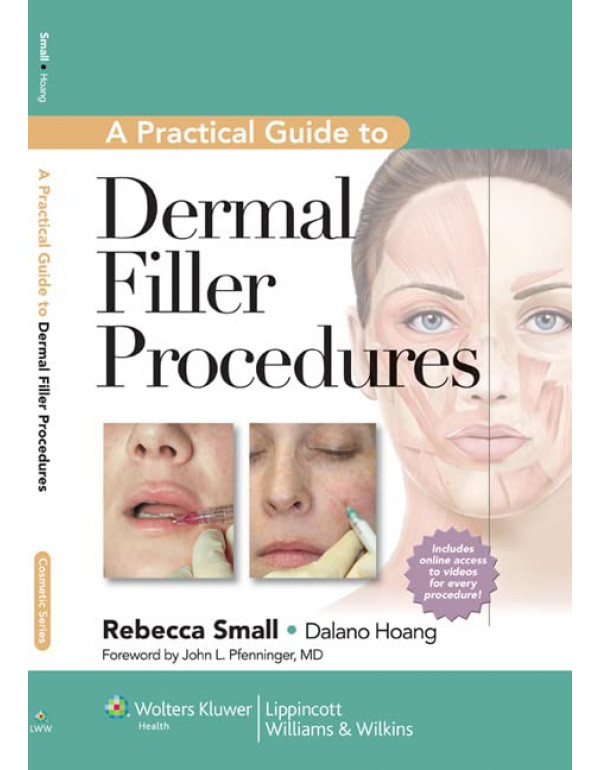 A Practical Guide to Dermal Filler Procedures *US ...